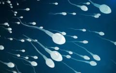 Infertilità e scarsa motilità degli spermatozoi - Astenospermia